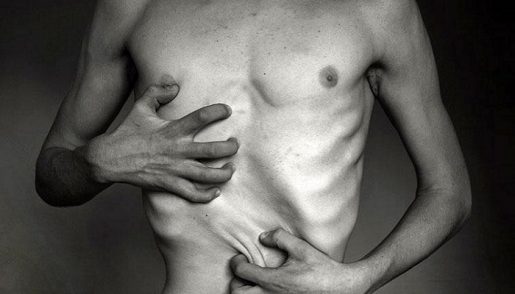 Cachexia