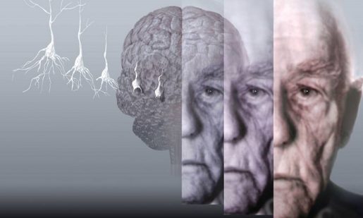 лечение альцгеймера